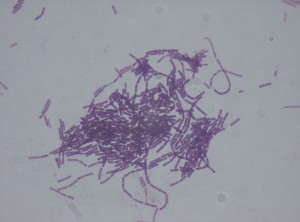 Bacillus_thuringiensis